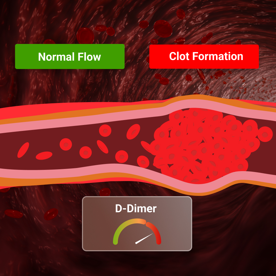 Cardiac Stress