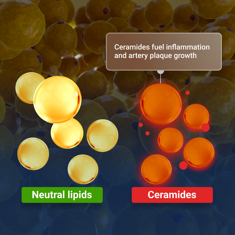 Ceramides