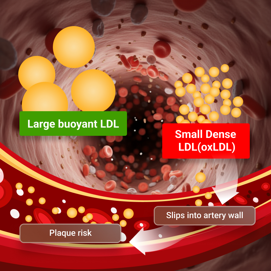 Plaque Activity