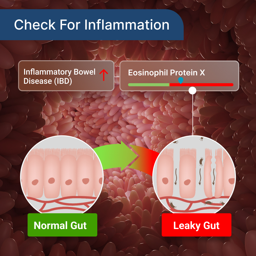 Next-Gen Gut Testing Webinar | Master The New Gut Zoomer